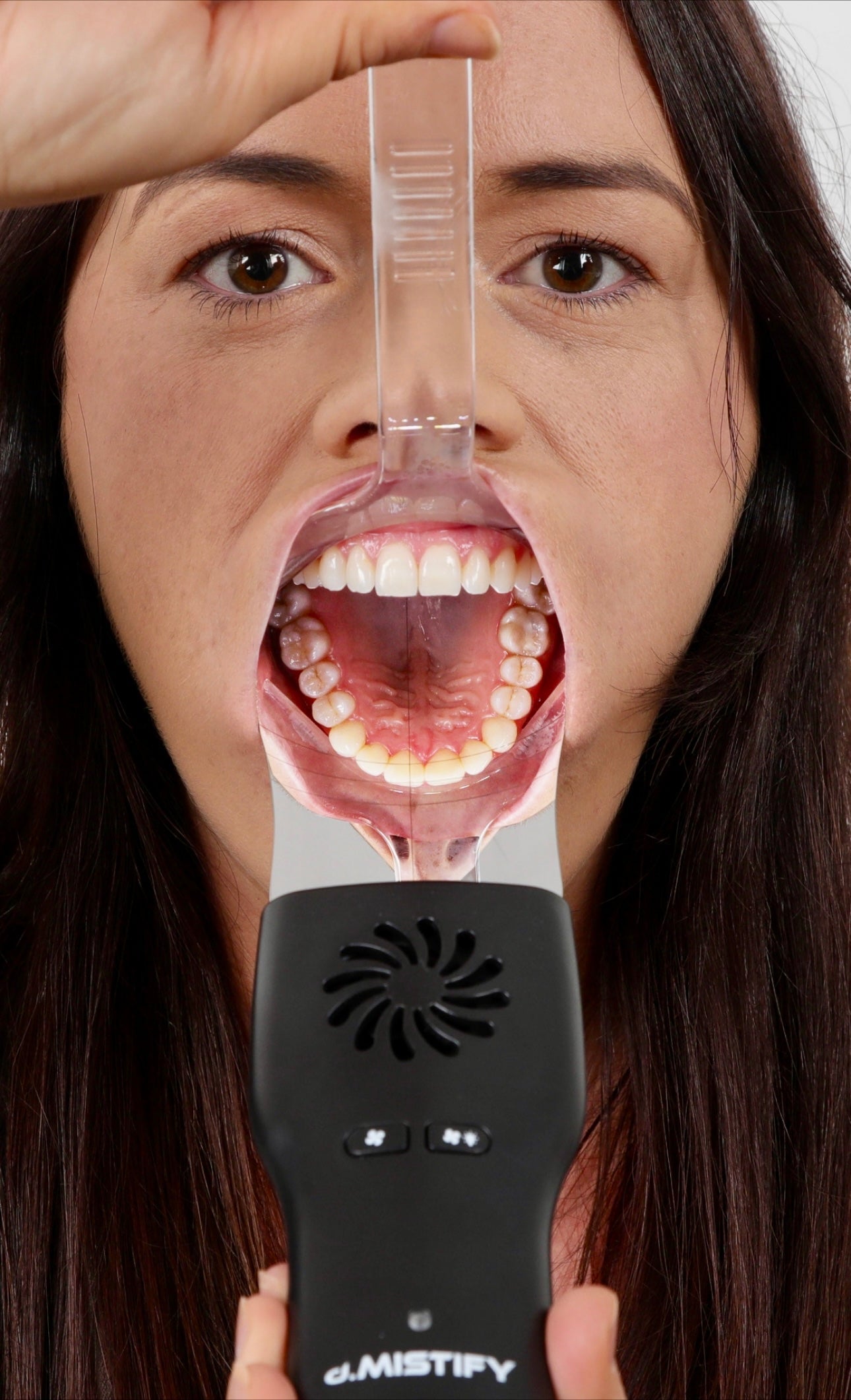 d.MISTIFY Pro Data Capture Kit: The Ultimate Dental Communication Tool