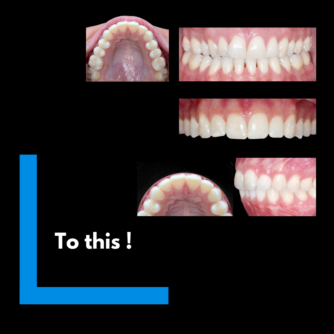 Certificate of Dento-Facial Photography, Triage and Monitoring Course