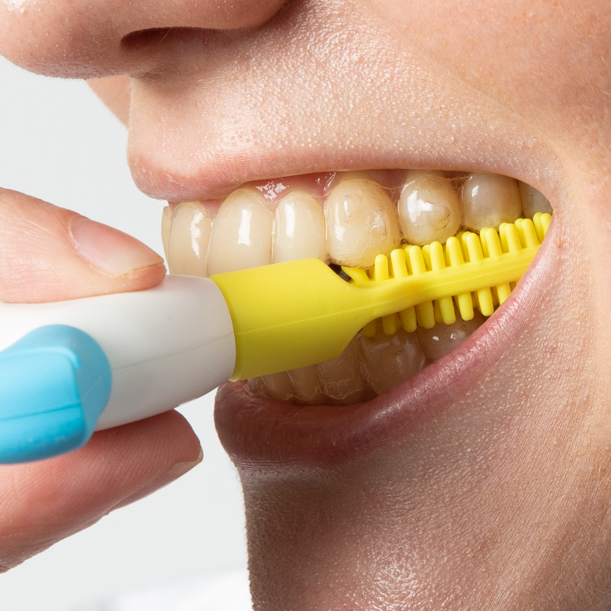 Munchies® Vibe engaged with posterior teeth
