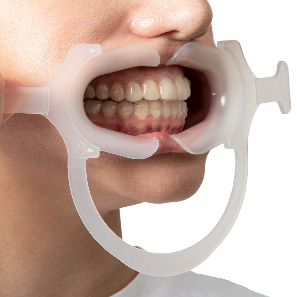 Hands Free Classic Retractors in mouth