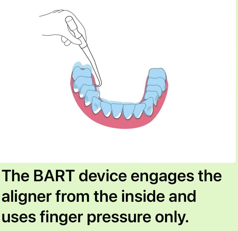 B.A.R.T (Bilingual Aligner Removal Tool)