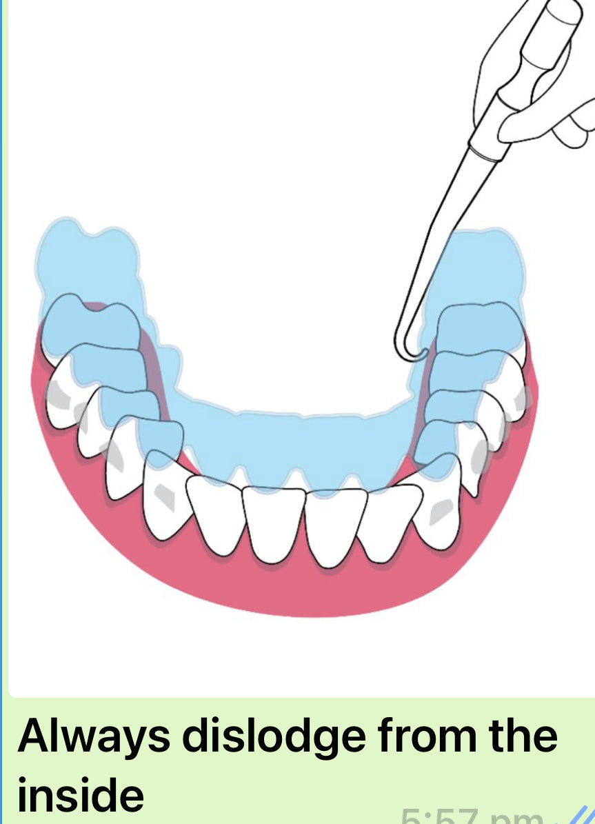 B.A.R.T (Bilingual Aligner Removal Tool)