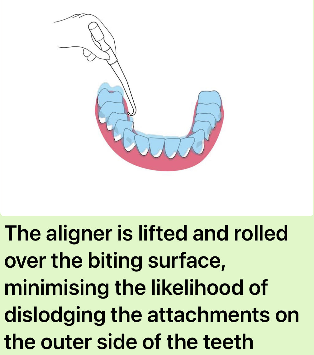 B.A.R.T (Bilingual Aligner Removal Tool)