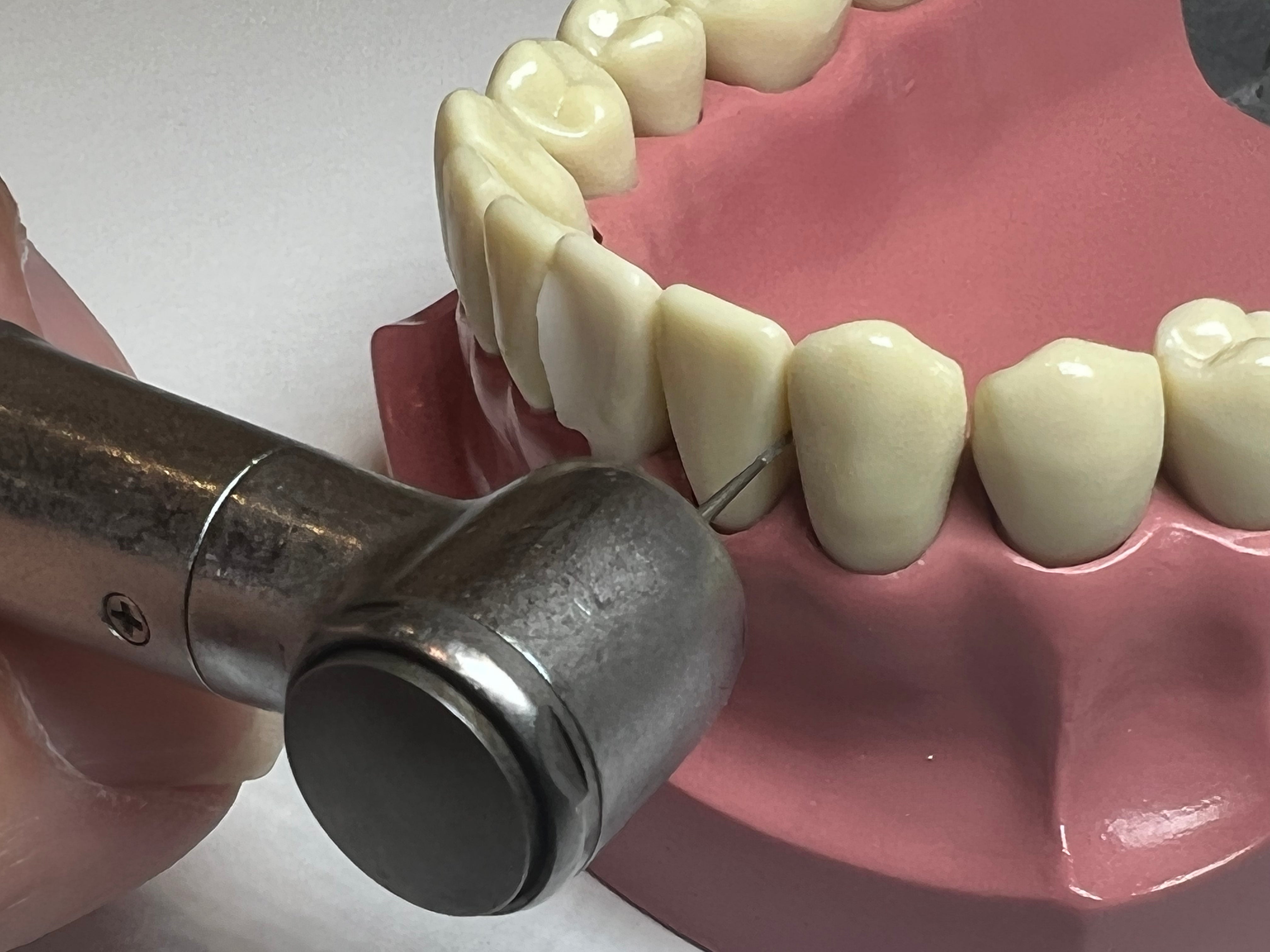 i-PR Extra Super Fine Bur 6.0mm (2, 5, 10 PC PKS)