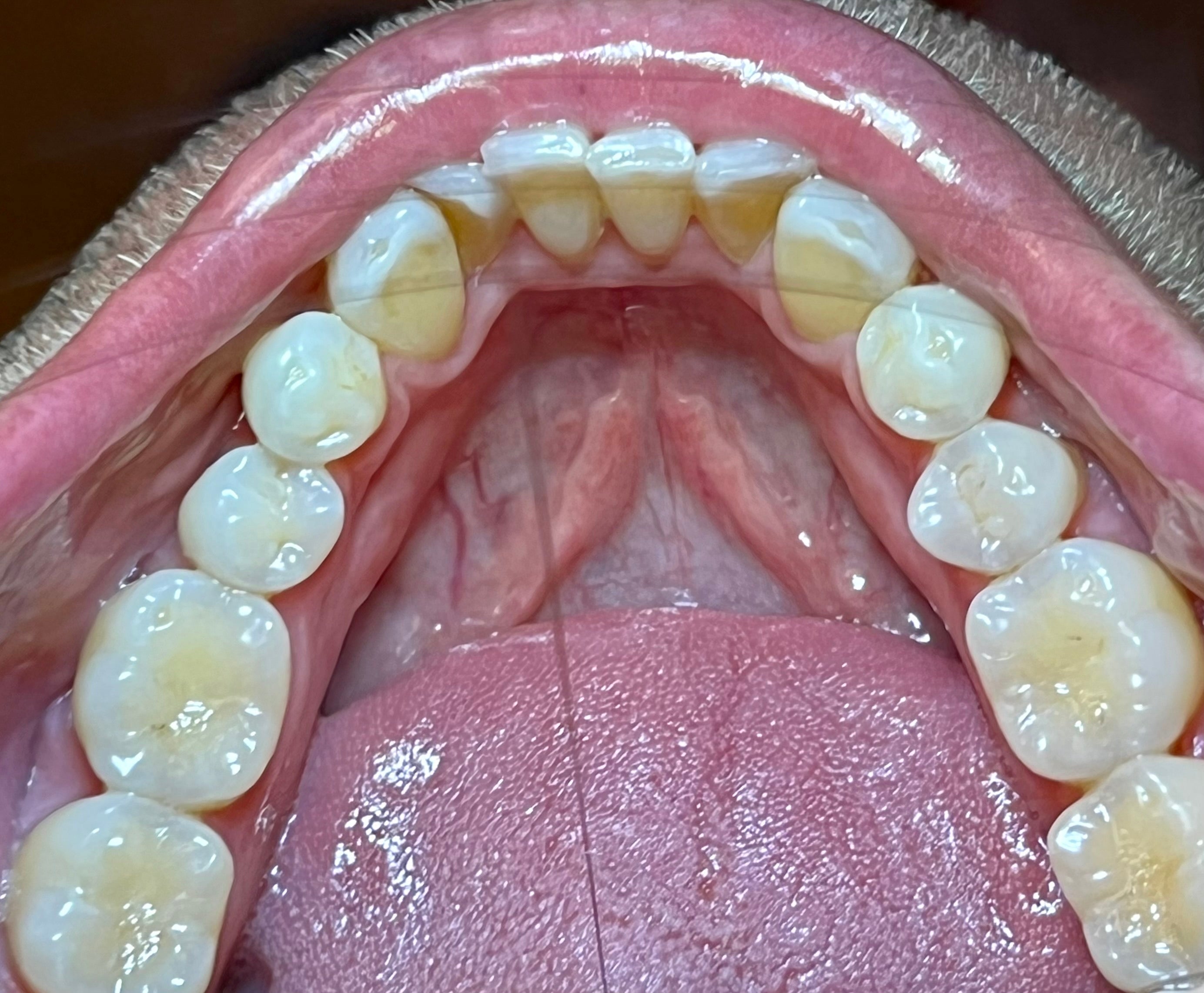 d.Mistify Data Capture Kit