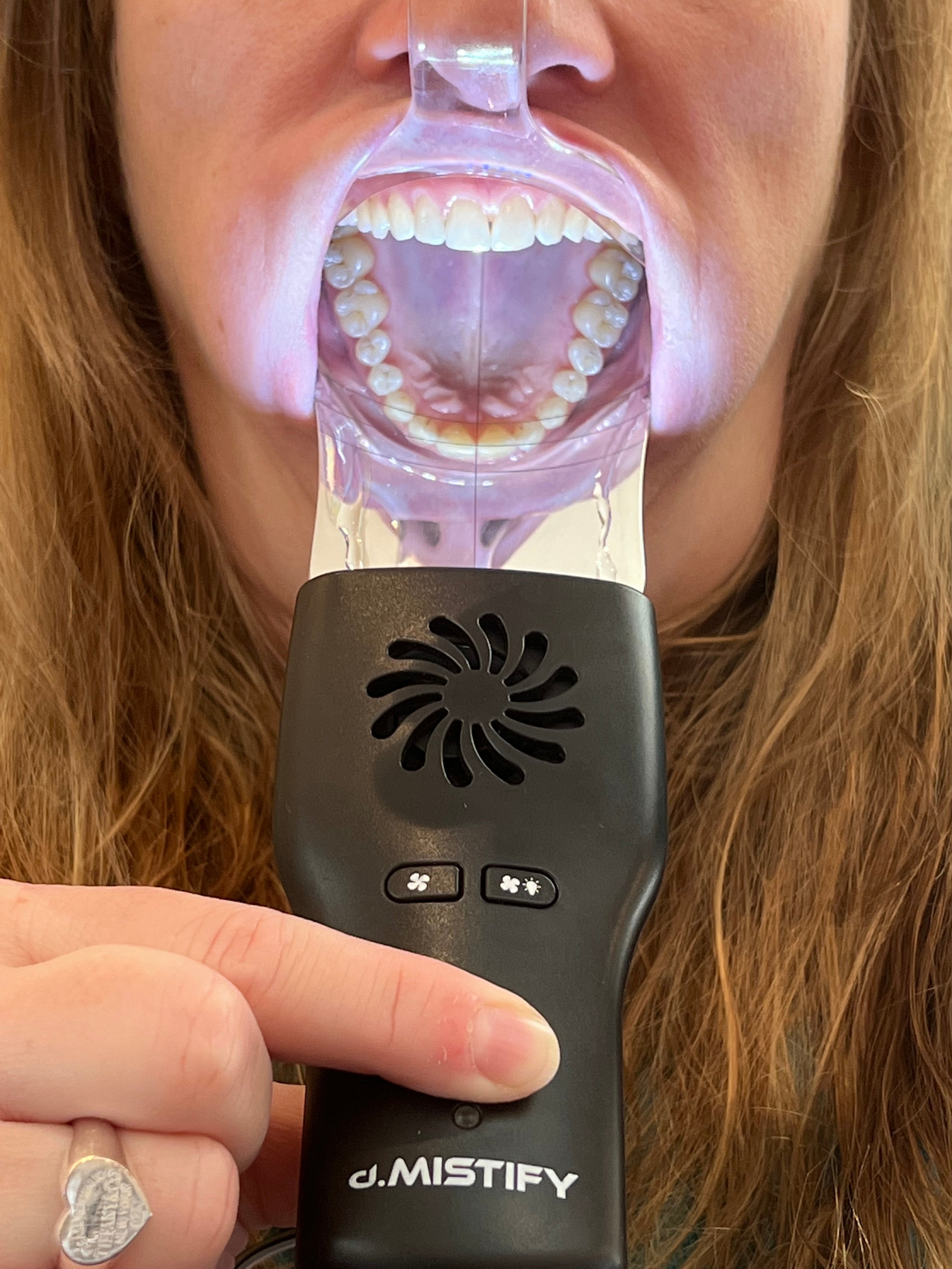 d.Mistify Data Capture Kit