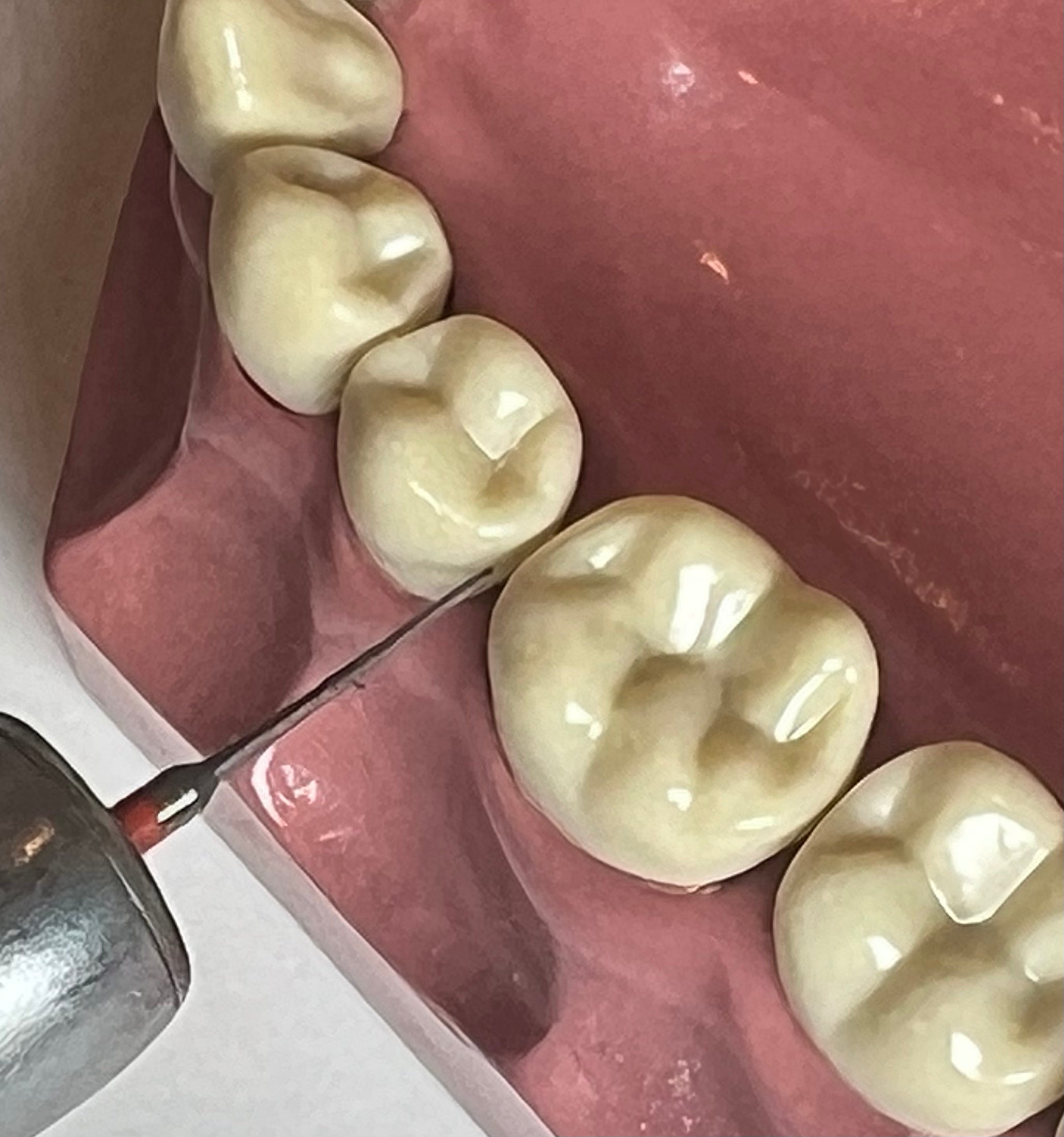 i-PR Super Fine Bur 3.5mm (2, 5, 10 PC PKS)
