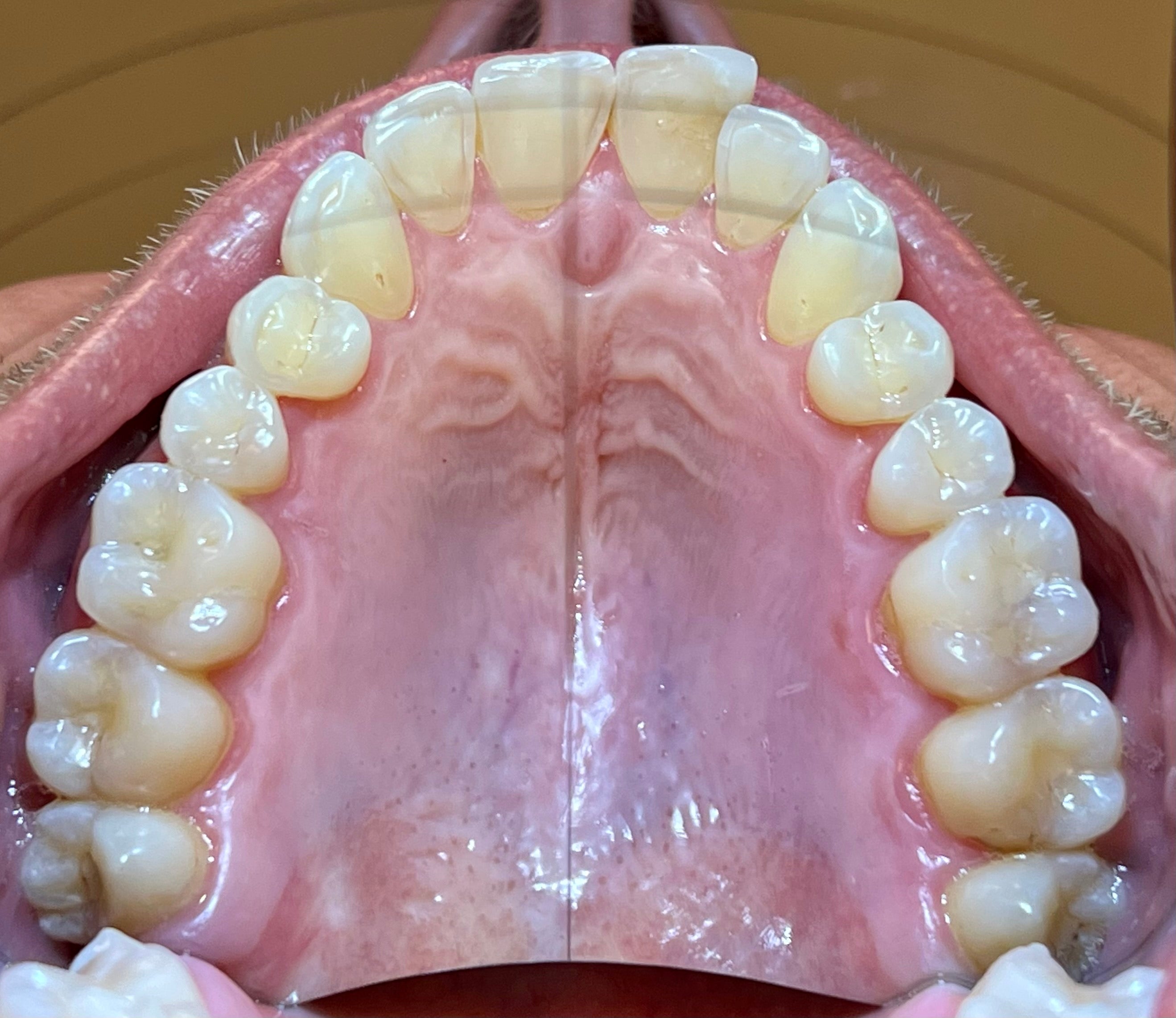 d.Mistify Data Capture Kit