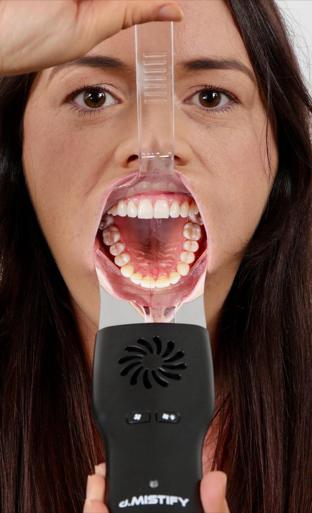 d.MISTIFY Pro Data Capture Kit: The Ultimate Dental Communication Tool