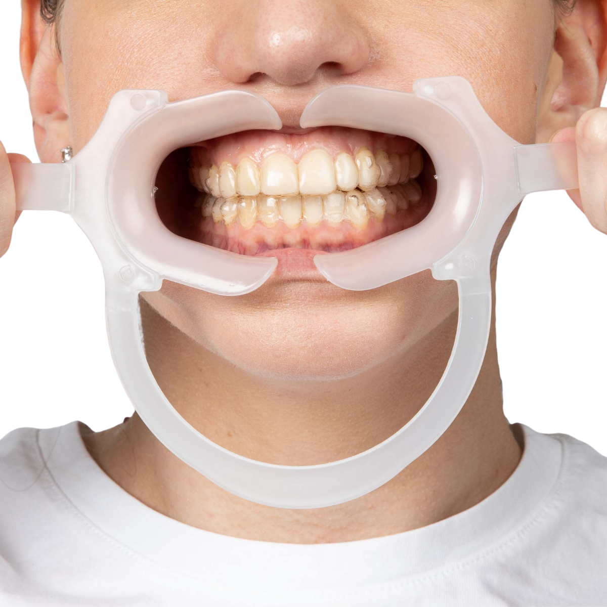 Hands Free Classic Retractors in mouth
