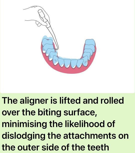B.A.R.T (Bilingual Aligner Removal Tool)