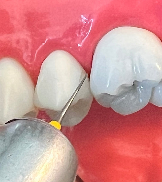 i-PR Extra Super Fine Bur 3.5mm (2, 5, 10 PC PKS)